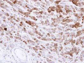 Immunohistochemistry (Formalin/PFA-fixed paraffin-embedded sections) - Anti-AKR1C1/AKR1C2 antibody (AB96087)