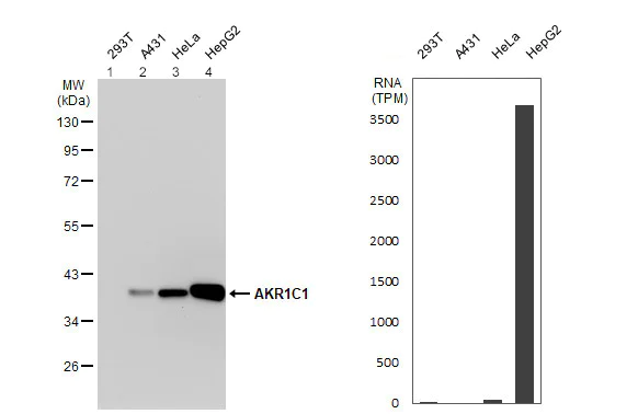 Western blot - Anti-AKR1C1/AKR1C2 antibody (AB96087)
