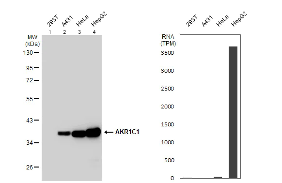 Western blot - Anti-AKR1C1/AKR1C2 antibody (AB96087)
