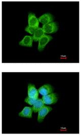 Immunocytochemistry/ Immunofluorescence - Anti-AKR1C1 antibody (AB192785)