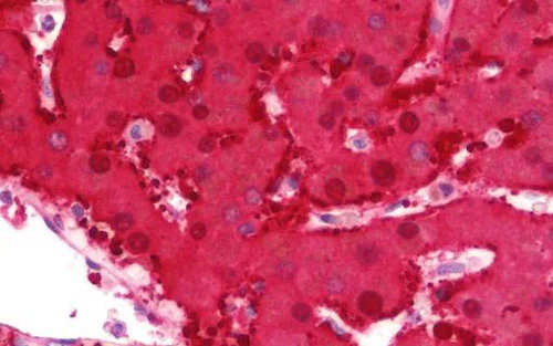 Immunohistochemistry (Formalin/PFA-fixed paraffin-embedded sections) - Anti-AKR1C1 antibody (AB192785)