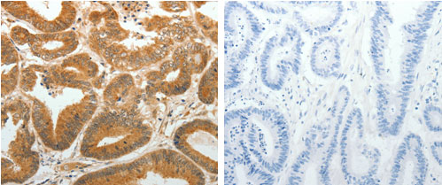 Immunohistochemistry (Formalin/PFA-fixed paraffin-embedded sections) - Anti-AKR1C1 antibody - C-terminal (AB183078)