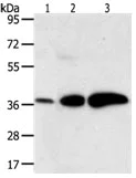 Western blot - Anti-AKR1C1 antibody - C-terminal (AB183078)