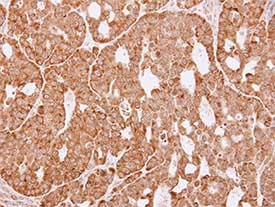 Immunohistochemistry (Formalin/PFA-fixed paraffin-embedded sections) - Anti-AKR1C3 antibody (AB137546), expandable thumbnail