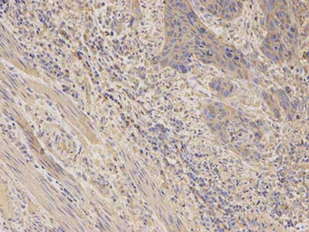 Immunohistochemistry (Formalin/PFA-fixed paraffin-embedded sections) - Anti-AKR1C3 antibody (AB196673)