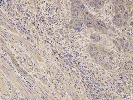 Immunohistochemistry (Formalin/PFA-fixed paraffin-embedded sections) - Anti-AKR1C3 antibody (AB196673)
