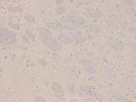 Immunohistochemistry (Formalin/PFA-fixed paraffin-embedded sections) - Anti-AKR1C3 antibody (AB196673)