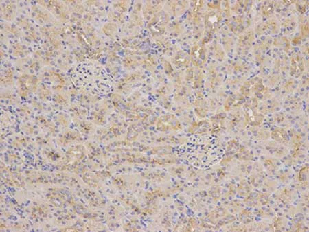 Immunohistochemistry (Formalin/PFA-fixed paraffin-embedded sections) - Anti-AKR1C3 antibody (AB196673)