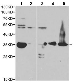 Western blot - Anti-AKR1C3 antibody (AB196673)
