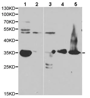 Western blot - Anti-AKR1C3 antibody (AB196673)