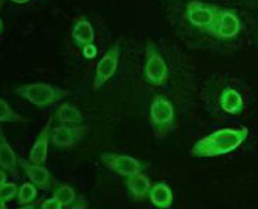 Immunocytochemistry/ Immunofluorescence - Anti-AKR1C3 antibody (AB84327), expandable thumbnail