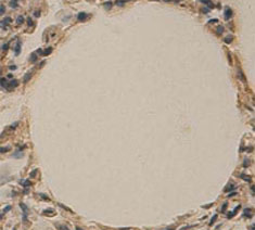 Immunohistochemistry (Formalin/PFA-fixed paraffin-embedded sections) - Anti-AKR1C3 antibody (AB84327), expandable thumbnail