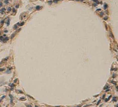 Immunohistochemistry (Formalin/PFA-fixed paraffin-embedded sections) - Anti-AKR1C3 antibody (AB84327)