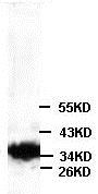 Western blot - Anti-AKR1C3 antibody (AB84327), expandable thumbnail