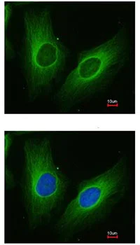 Immunocytochemistry/ Immunofluorescence - Anti-AKR1C3 antibody - C-terminal (AB137545)