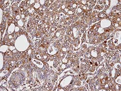 Immunohistochemistry (Formalin/PFA-fixed paraffin-embedded sections) - Anti-AKR1C3 antibody - C-terminal (AB137545)