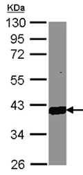 Western blot - Anti-AKR1C3 antibody - C-terminal (AB137545)