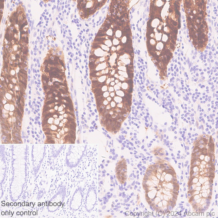 Immunohistochemistry (Formalin/PFA-fixed paraffin-embedded sections) - Anti-AKR1C3 antibody [EPR28747-41] (ab316864), expandable thumbnail