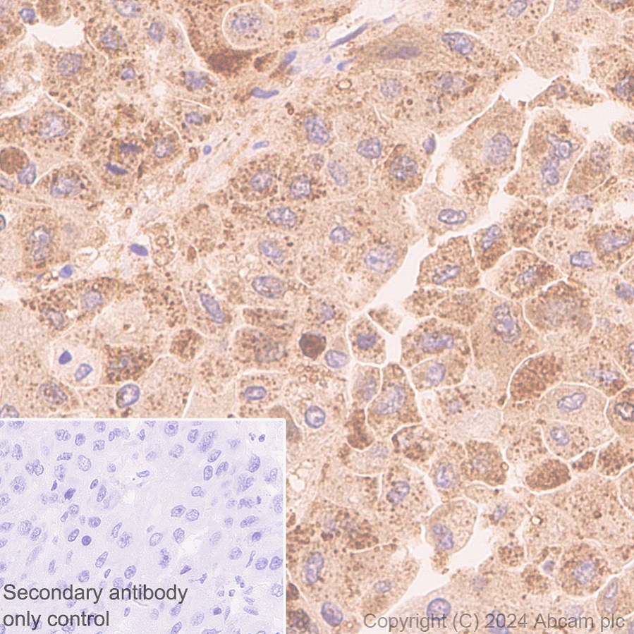 Immunohistochemistry (Formalin/PFA-fixed paraffin-embedded sections) - Anti-AKR1C3 antibody [EPR28747-41] (ab316864), expandable thumbnail