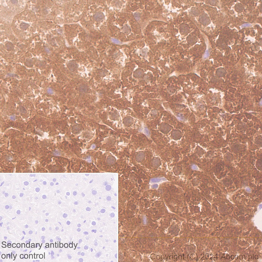 Immunohistochemistry (Formalin/PFA-fixed paraffin-embedded sections) - Anti-AKR1C3 antibody [EPR28747-41] (ab316864), expandable thumbnail