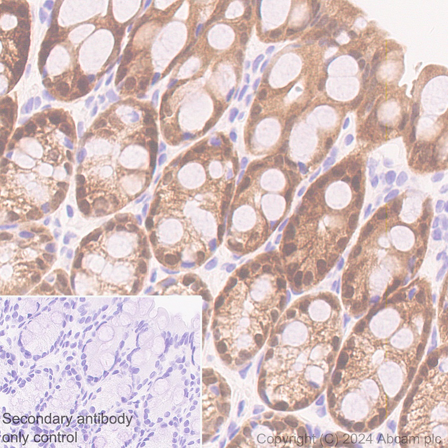 Immunohistochemistry (Formalin/PFA-fixed paraffin-embedded sections) - Anti-AKR1C3 antibody [EPR28747-41] (ab316864), expandable thumbnail
