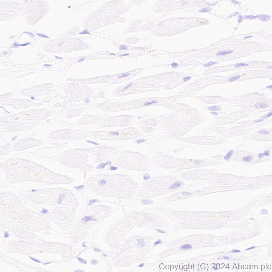 Immunohistochemistry (Formalin/PFA-fixed paraffin-embedded sections) - Anti-AKR1C3 antibody [EPR28747-41] (ab316864), expandable thumbnail