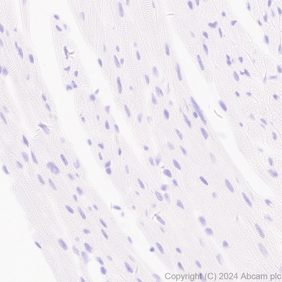 Immunohistochemistry (Formalin/PFA-fixed paraffin-embedded sections) - Anti-AKR1C3 antibody [EPR28747-41] (ab316864), expandable thumbnail