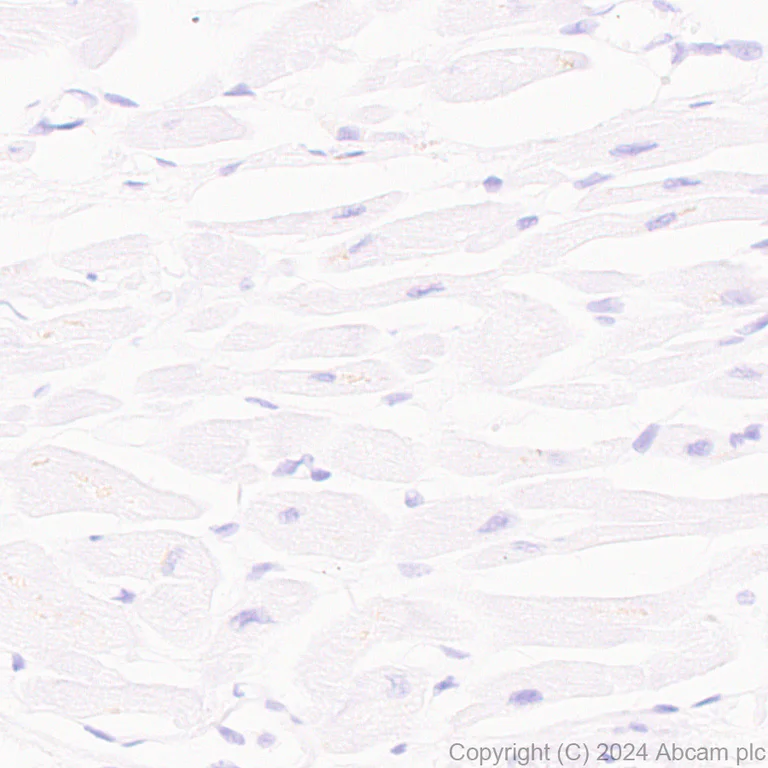 Immunohistochemistry (Formalin/PFA-fixed paraffin-embedded sections) - Anti-AKR1C3 antibody [EPR28747-41] - BSA and Azide free (AB316865)