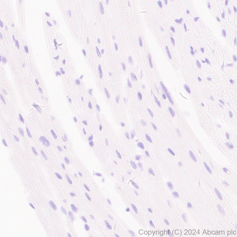 Immunohistochemistry (Formalin/PFA-fixed paraffin-embedded sections) - Anti-AKR1C3 antibody [EPR28747-41] - BSA and Azide free (AB316865)