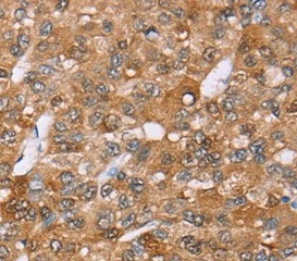 Immunohistochemistry (Formalin/PFA-fixed paraffin-embedded sections) - Anti-AKR1C4 antibody (AB197973)