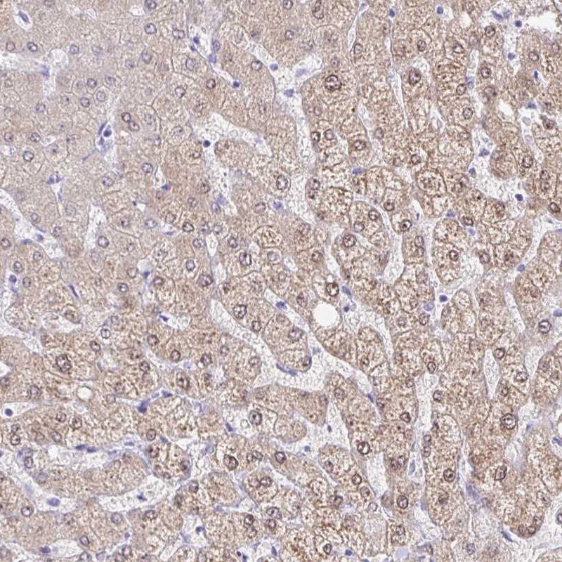 Immunohistochemistry (Formalin/PFA-fixed paraffin-embedded sections) - Anti-AKR1D1 antibody (AB254943)