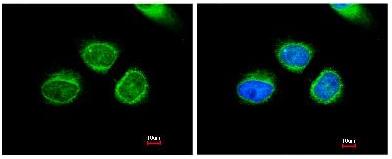 Immunocytochemistry/ Immunofluorescence - Anti-AKR7A2 antibody (AB97458)