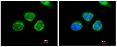 Immunocytochemistry/ Immunofluorescence - Anti-AKR7A2 antibody (AB97458)