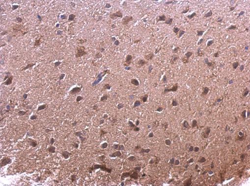 Immunohistochemistry (Formalin/PFA-fixed paraffin-embedded sections) - Anti-AKR7A2 antibody (AB97458), expandable thumbnail