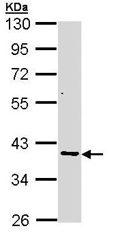 Western blot - Anti-AKR7A2 antibody (AB97458), expandable thumbnail