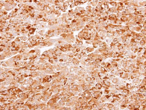 Immunohistochemistry (Formalin/PFA-fixed paraffin-embedded sections) - Anti-AKR7A3 antibody (AB227231), expandable thumbnail