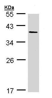 Western blot - Anti-AKR7A3 antibody (AB227231), expandable thumbnail