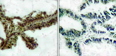 Immunohistochemistry (Formalin/PFA-fixed paraffin-embedded sections) - Anti-AKT (phospho T308) antibody (AB38449)