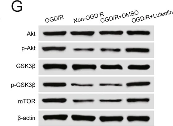 Western blot - Anti-AKT (phospho T308) antibody (AB38449)