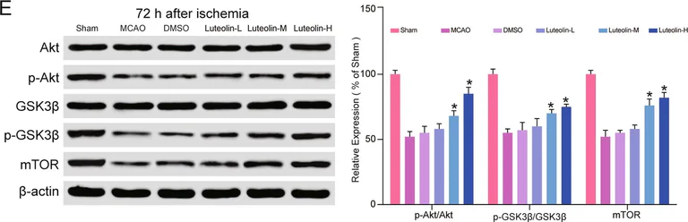 Western blot - Anti-AKT (phospho T308) antibody (AB38449)
