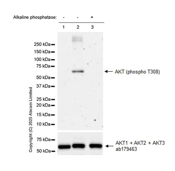 Western blot - Anti-AKT (phospho T308) antibody [EPR26565-137] (AB324741)