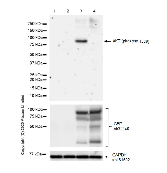 Western blot - Anti-AKT (phospho T308) antibody [EPR26565-137] (AB324741)