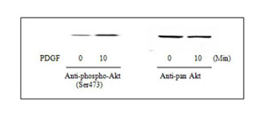 Western blot - Akt (pS473) + total Akt ELISA Kit (AB126433), expandable thumbnail