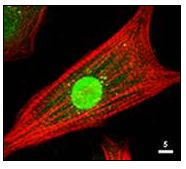 Immunocytochemistry/ Immunofluorescence - Anti-AKT1 + AKT2 + AKT3 antibody (AB106693), expandable thumbnail