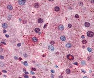 Immunohistochemistry (Formalin/PFA-fixed paraffin-embedded sections) - Anti-AKT1 + AKT2 + AKT3 antibody (AB106693), expandable thumbnail
