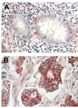 Immunohistochemistry (Formalin/PFA-fixed paraffin-embedded sections) - Anti-AKT1 + AKT2 + AKT3 antibody (AB106693), expandable thumbnail