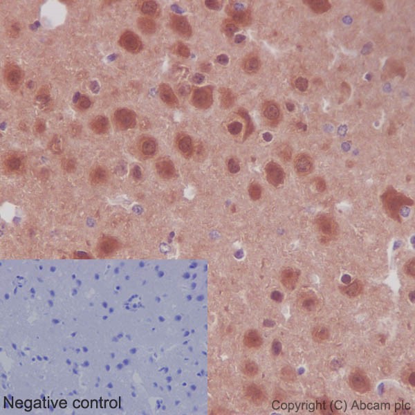 Immunohistochemistry (Formalin/PFA-fixed paraffin-embedded sections) - Anti-AKT1 + AKT2 + AKT3 antibody [EPR16798] (ab179463), expandable thumbnail