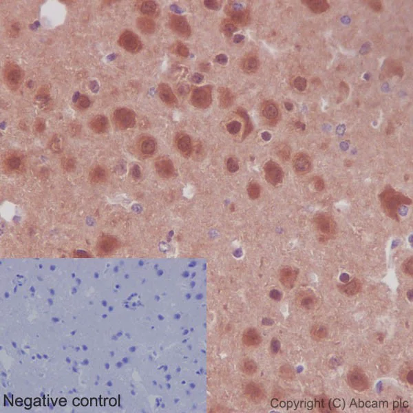 Immunohistochemistry (Formalin/PFA-fixed paraffin-embedded sections) - Anti-AKT1 + AKT2 + AKT3 antibody [EPR16798] (AB179463)