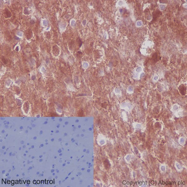 Immunohistochemistry (Formalin/PFA-fixed paraffin-embedded sections) - Anti-AKT1 + AKT2 + AKT3 antibody [EPR16798] (AB179463)
