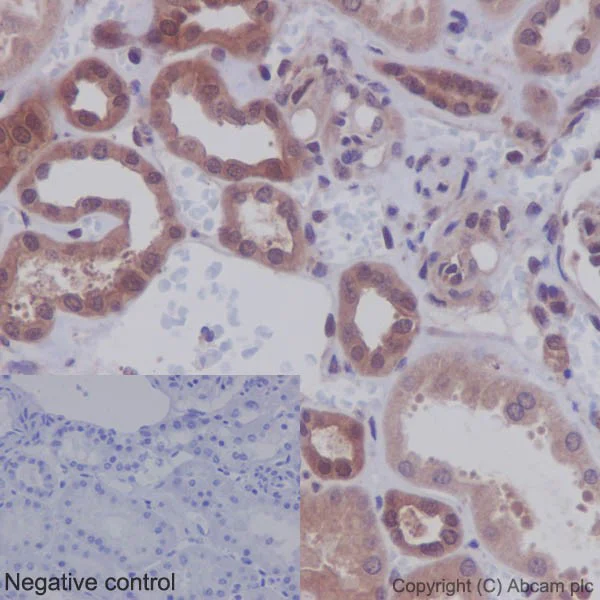 Immunohistochemistry (Formalin/PFA-fixed paraffin-embedded sections) - Anti-AKT1 + AKT2 + AKT3 antibody [EPR16798] (AB179463)